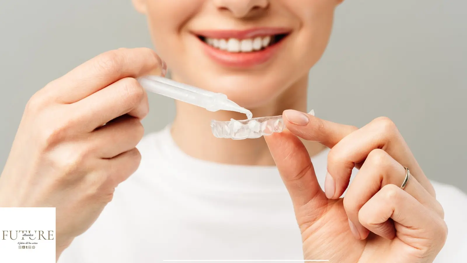 Mascherine personalizzate per lo studio dentistico