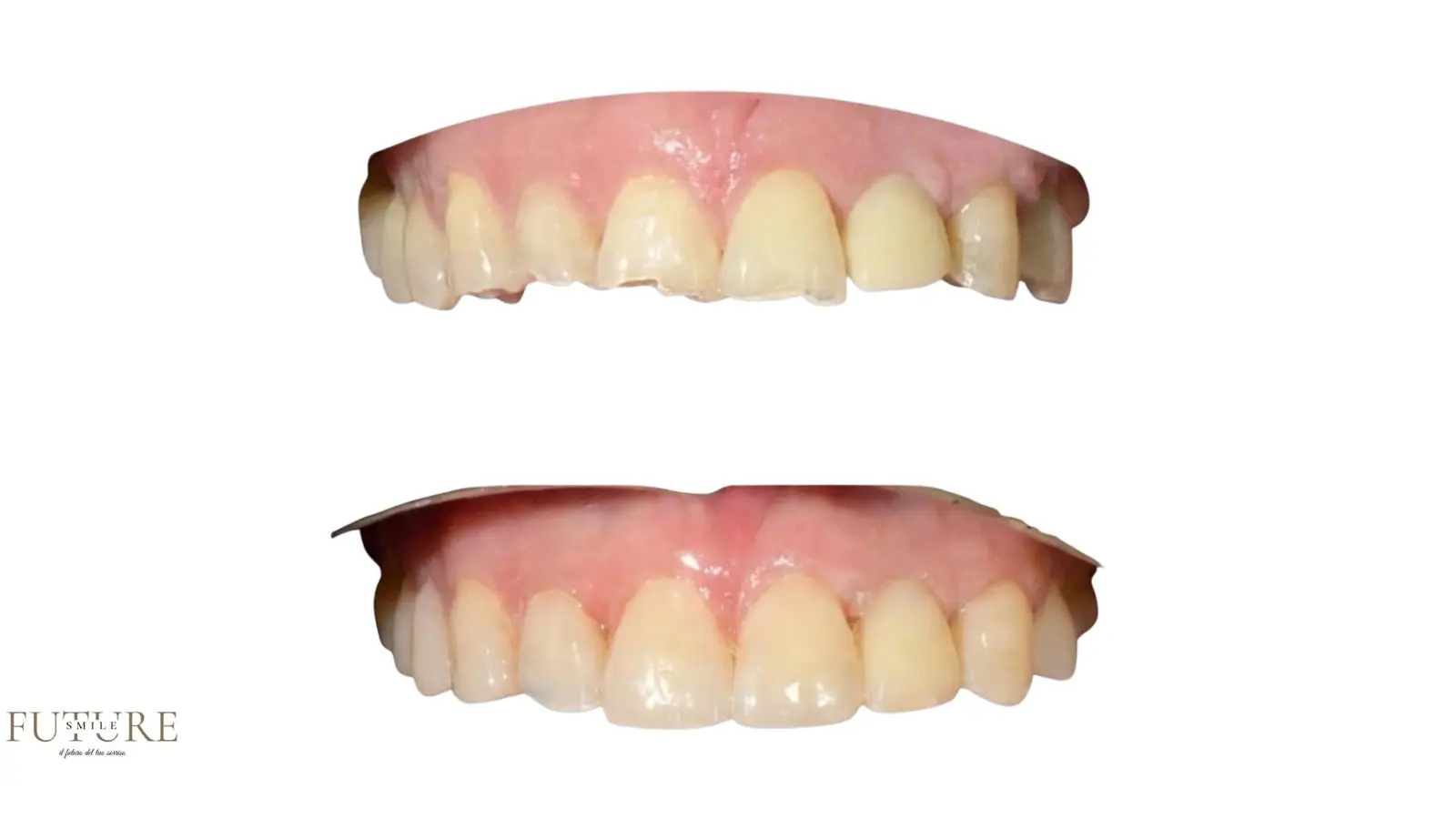 Dettaglio di una lavorazione Future Smile
