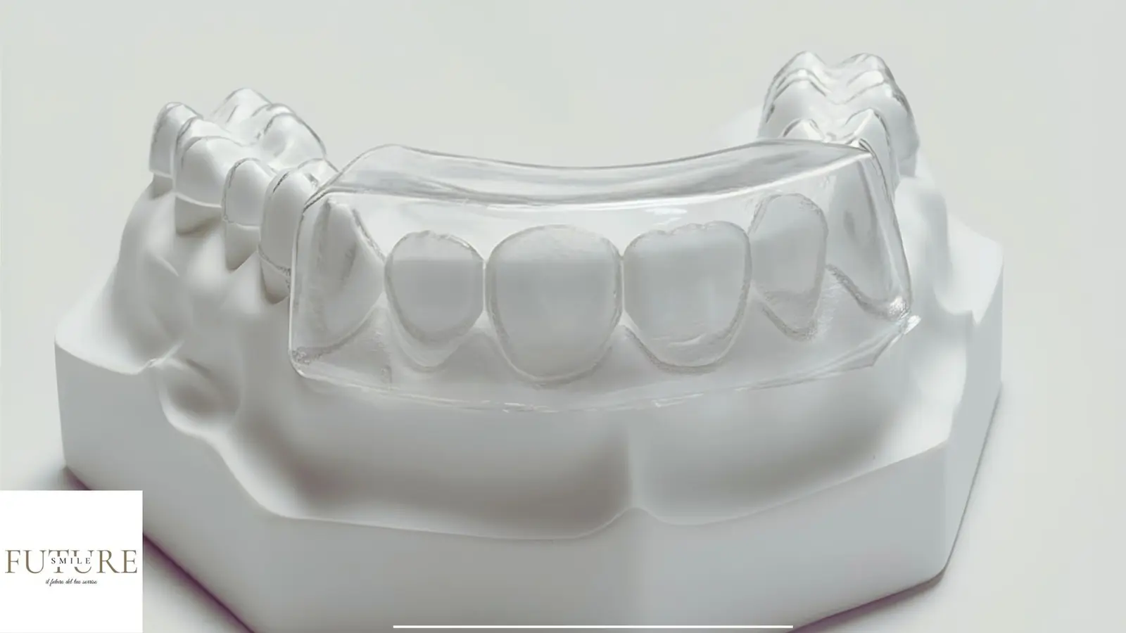 Dima per tecnica injection progettata digitalmente