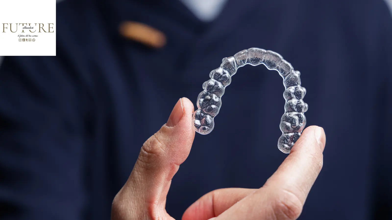 Allineatore trasparente personalizzato per ortodonzia invisibile