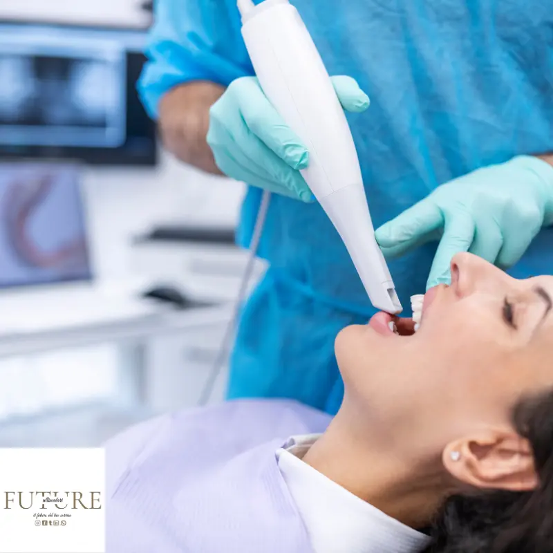 Impronta dentale per paradente personalizzato